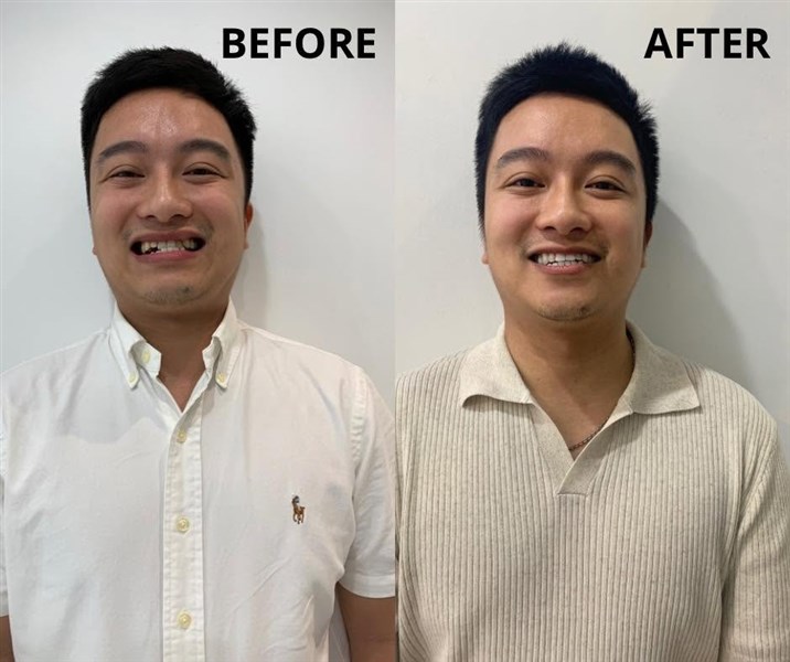 Khi bản lĩnh người đàn ông đến từ nụ cười tự tin