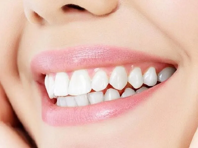 Trồng răng giả có ảnh hưởng gì không? một số lưu ý quan trọng