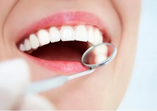 Răng thẩm mỹ